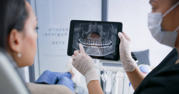 Licensed Dental Implants service in Iowa, IA - Smile Center Dentistry
